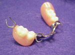 Removable Partial Dentures