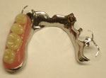 Removable Partial Dentures