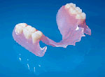 Removable Partial Dentures